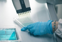 What is the most commonly used Elisa test?