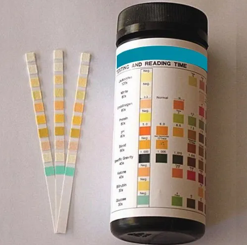 Is there an app to read urine test strips?