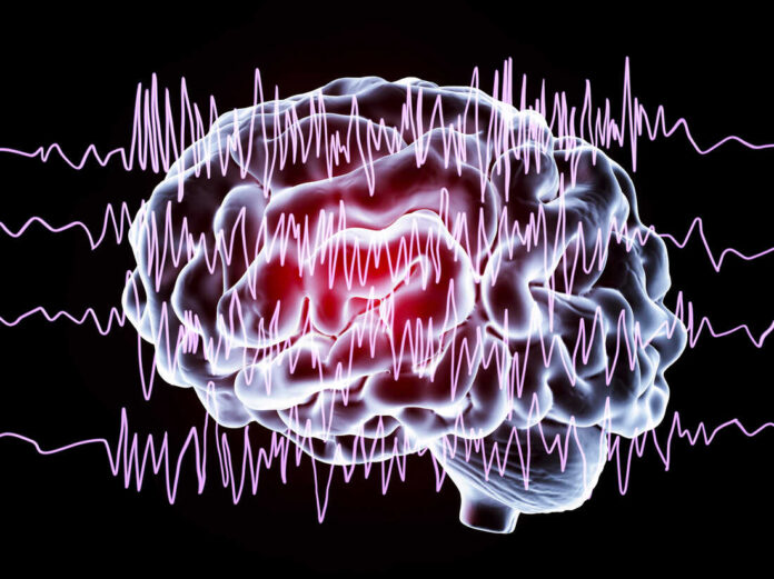 Epilepsy Care with Technological Advancements