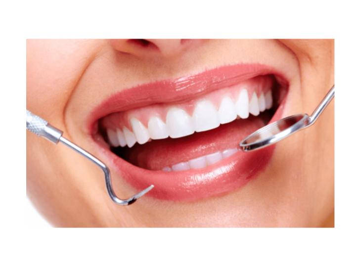 Explore Dental Cosmetic Procedures to Improve Your Smile