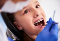 Beyond Braces: The Modern Face of Cosmetic Dentistry for Orthodontics