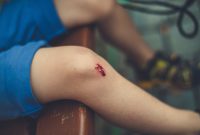 What You Need to Know About Trip, Slip, and Fall Injuries