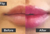 Lip Flip Before And After- Know Better About This Sensation