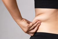 The Rise of CoolSculpting: Why It’s the Go-To Fat Reduction Solution