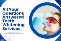 All Your Questions Answered – Teeth Whitening Services